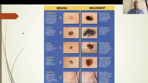 Melanoma Update for General Practice with Dr Dan Walker