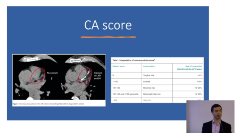 Cardiovascular Disease in the middle aged man presented by A/Prof Kuljit Singh