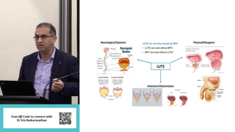 Benign Prostatic Hyperplasia Male Lower Urinary Tract Symptoms (LUTS)