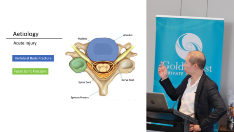 Cervical Radiculopathy - What are the surgical options