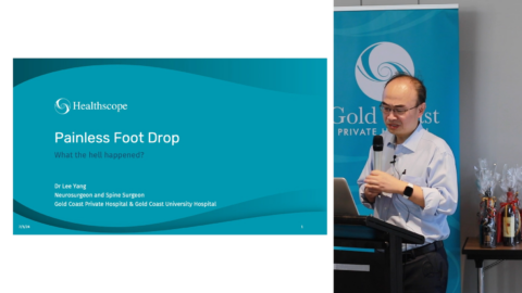 Painless Foot Drop